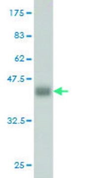 Monoclonal Anti-ADH4 antibody produced in mouse clone 3C5, purified immunoglobulin, buffered aqueous solution