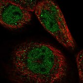 Anti-CCDC113 antibody produced in rabbit Prestige Antibodies® Powered by Atlas Antibodies, affinity isolated antibody, buffered aqueous glycerol solution