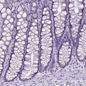 Anti-SPEF1 antibody produced in rabbit Prestige Antibodies® Powered by Atlas Antibodies, affinity isolated antibody, buffered aqueous glycerol solution
