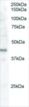 Anti-Dysadherin antibody produced in goat affinity isolated antibody, buffered aqueous solution