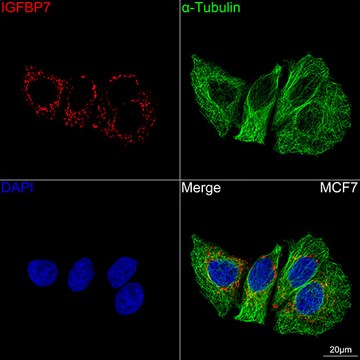 Anti-IGFBP7 Antibody, clone 8M10Q9, Rabbit Monoclonal