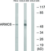 Anti-ARMC6 antibody produced in rabbit affinity isolated antibody