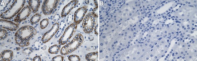 Anti-Ankyrin-G Antibody, clone 1D11 ZooMAb&#174; Rabbit Monoclonal recombinant, expressed in HEK 293 cells