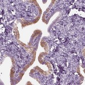 Anti-TMEM231 antibody produced in rabbit Prestige Antibodies® Powered by Atlas Antibodies, affinity isolated antibody, buffered aqueous glycerol solution