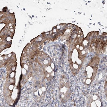 Anti-SCN11A antibody produced in rabbit Prestige Antibodies&#174; Powered by Atlas Antibodies, affinity isolated antibody, buffered aqueous glycerol solution