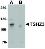 Anti-TSHZ3 antibody produced in rabbit affinity isolated antibody