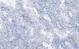 Anti-Endoglin Antibody, clone 1I15 ZooMAb® Rabbit Monoclonal recombinant, expressed in HEK 293 cells