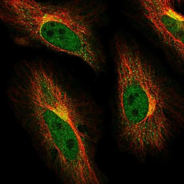 Anti-ABCG1 antibody produced in rabbit Prestige Antibodies&#174; Powered by Atlas Antibodies, affinity isolated antibody, buffered aqueous glycerol solution, ab1