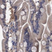 Anti-GLOD4 antibody produced in rabbit Prestige Antibodies® Powered by Atlas Antibodies, affinity isolated antibody, buffered aqueous glycerol solution, Ab3