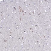 Anti-CA10 antibody produced in rabbit Prestige Antibodies® Powered by Atlas Antibodies, affinity isolated antibody, buffered aqueous glycerol solution