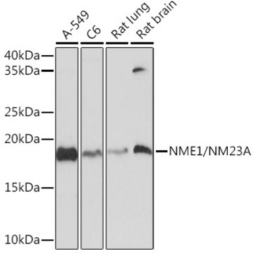 Anti-NME1/NM23A Antibody, clone 3R7X7, Rabbit Monoclonal