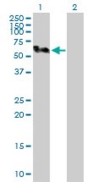 Anti-SMU1 antibody produced in rabbit purified immunoglobulin, buffered aqueous solution