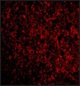 Anti-TMP21 (ab1) antibody produced in rabbit affinity isolated antibody, buffered aqueous solution