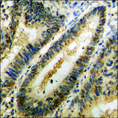 Anti-phospho-p73 (pTyr99) antibody produced in rabbit affinity isolated antibody