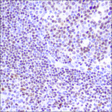 Anti-PU.1 antibody, Rabbit monoclonal recombinant, expressed in proprietary host, clone SP238, affinity isolated antibody