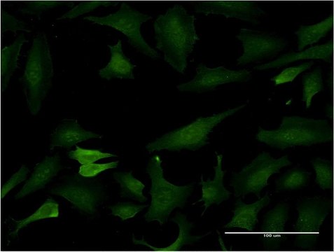 Monoclonal Anti-BCL7C antibody produced in mouse clone 1A4, purified immunoglobulin, buffered aqueous solution