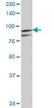 Anti-PFKM antibody produced in mouse purified immunoglobulin, buffered aqueous solution