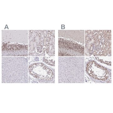 Anti-SIN3A antibody produced in rabbit Prestige Antibodies&#174; Powered by Atlas Antibodies, affinity isolated antibody, buffered aqueous glycerol solution