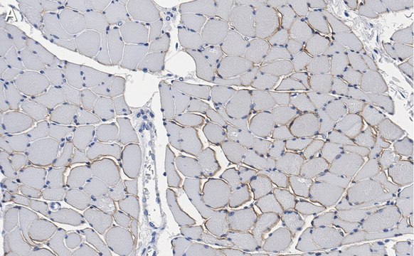 Anti-Dystrophin Antibody, clone 2C6 (MANDYS106) ZooMAb&#174; Mouse Monoclonal recombinant, expressed in HEK 293 cells