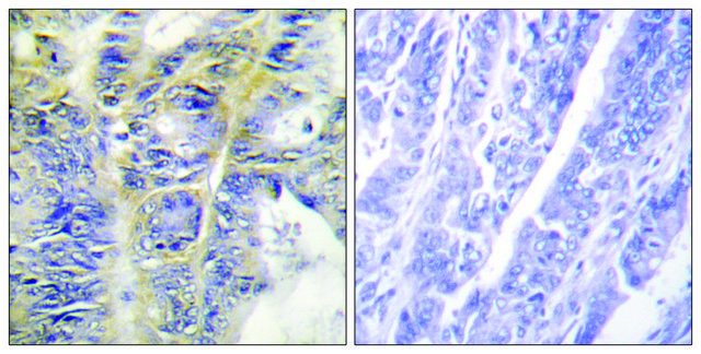 抗胶原蛋白IV &#945;5 兔抗 affinity isolated antibody