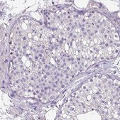 Anti-HTRA4 antibody produced in rabbit Prestige Antibodies® Powered by Atlas Antibodies, affinity isolated antibody, buffered aqueous glycerol solution