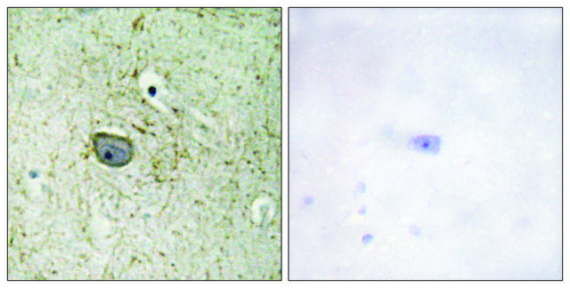 Anti-PDGFR &#945; antibody produced in rabbit affinity isolated antibody