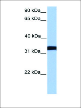 Anti-LDHC antibody produced in rabbit affinity isolated antibody