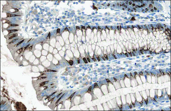 Anti-HAVCR1 antibody produced in rabbit Prestige Antibodies&#174; Powered by Atlas Antibodies, affinity isolated antibody, buffered aqueous glycerol solution