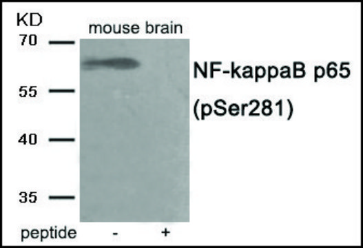 抗-磷酸化-NF-&#954;B p65 (pSer281) 兔抗 affinity isolated antibody