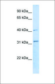 Anti-STUB1 antibody produced in rabbit affinity isolated antibody