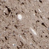 Anti-MLF2 antibody produced in rabbit Ab1, Prestige Antibodies® Powered by Atlas Antibodies, affinity isolated antibody, buffered aqueous glycerol solution