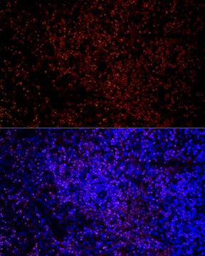 Anti-IKZF3 Antibody, clone 4U7F9, Rabbit Monoclonal