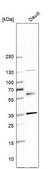 Anti-SLAMF6 antibody produced in rabbit Prestige Antibodies® Powered by Atlas Antibodies, affinity isolated antibody, buffered aqueous glycerol solution