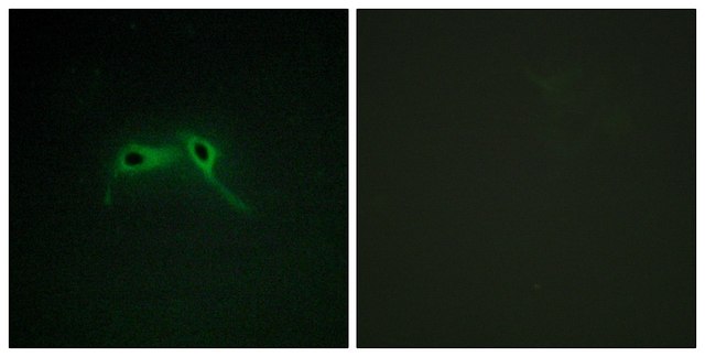 Anti-NF1 antibody produced in rabbit affinity isolated antibody