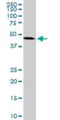 Monoclonal Anti-ADPRH antibody produced in mouse clone 1F11, purified immunoglobulin, buffered aqueous solution