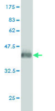 ANTI-GUCY2D antibody produced in mouse clone 6E9, purified immunoglobulin, buffered aqueous solution