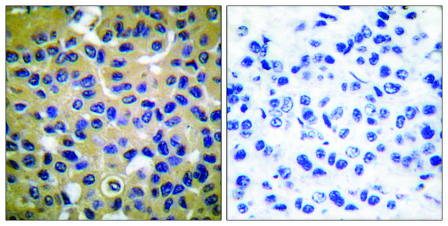 抗 胶原 II 兔抗 affinity isolated antibody