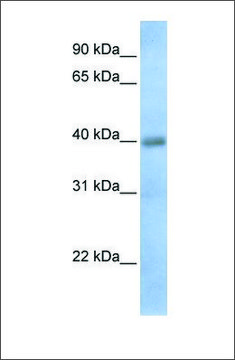 Anti-TXNDC15 antibody produced in rabbit affinity isolated antibody