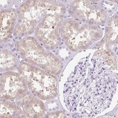 Anti-COL9A2 antibody produced in rabbit Prestige Antibodies® Powered by Atlas Antibodies, affinity isolated antibody, buffered aqueous glycerol solution