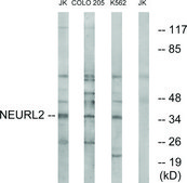 Anti-NEURL2 antibody produced in rabbit affinity isolated antibody