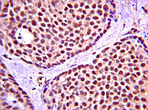 Anti-phospho-AMPK1 (Thr174) Antibody from rabbit, purified by affinity chromatography