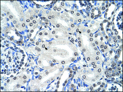 Anti-FOXJ1 antibody produced in rabbit affinity isolated antibody