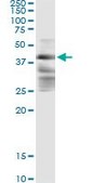 Monoclonal Anti-ZFYVE19 antibody produced in mouse clone 3G4-2B11, purified immunoglobulin, buffered aqueous solution