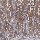 Anti-IL11RA antibody produced in rabbit Prestige Antibodies® Powered by Atlas Antibodies, affinity isolated antibody, buffered aqueous glycerol solution