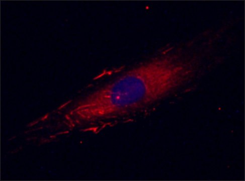 Anti-Fibronectin antibody, Mouse monoclonal clone FN-15, purified from hybridoma cell culture