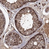 Anti-GRPEL1 antibody produced in rabbit Prestige Antibodies® Powered by Atlas Antibodies, affinity isolated antibody, buffered aqueous glycerol solution