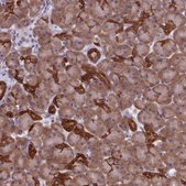 Anti-RPS26 antibody produced in rabbit Prestige Antibodies® Powered by Atlas Antibodies, affinity isolated antibody, buffered aqueous glycerol solution