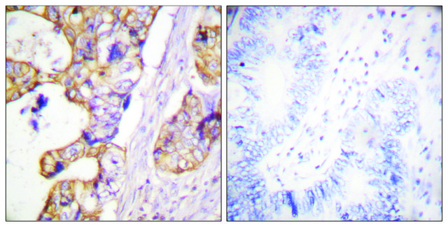 Anti-Keratin 8 antibody produced in rabbit affinity isolated antibody