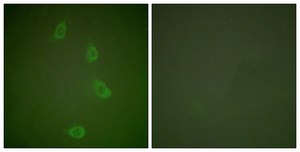 Anti-HSP40 antibody produced in rabbit affinity isolated antibody
