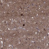 Anti-SLC4A10 antibody produced in rabbit Prestige Antibodies® Powered by Atlas Antibodies, affinity isolated antibody, buffered aqueous glycerol solution